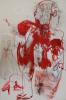 Picture - Base of the brain... tant pis j&#039;y vais 
